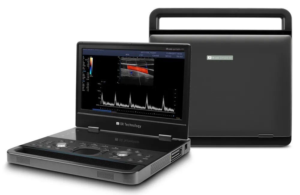 ORsono Portable V11 mobile ultrasound systems shown in open and closed positions