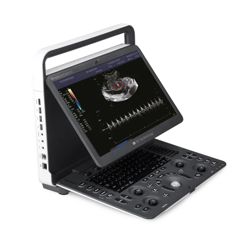 ORsono Portable V2 mobile ultrasound device for equine veterinary use