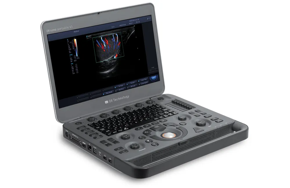 ORsono Portable V3 ultrasound device open side view for veterinary use