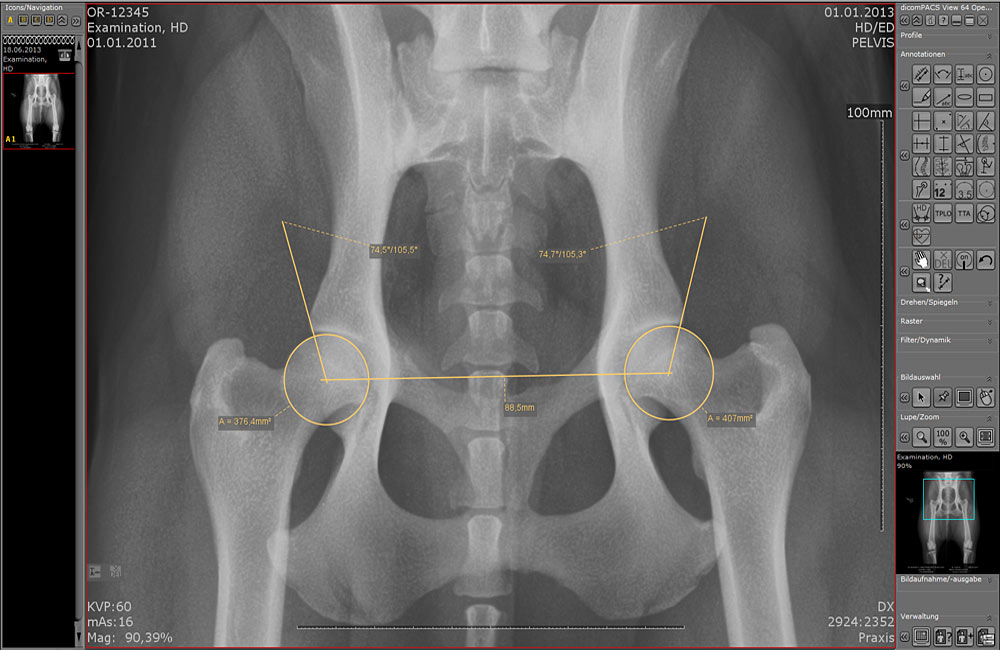 Hip X-ray with AI-measured Norberg angle using dicomPACS vet software